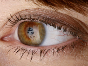 Read more about the article Eye Care – Natural Treatments
