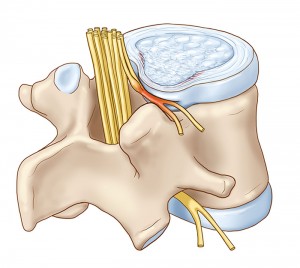 Read more about the article How To Deal With Sciatica