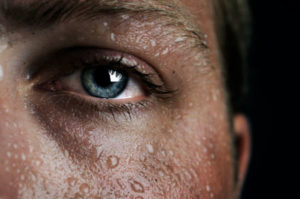 Read more about the article Excessive Sweating Should Not Be Treated With Indifference