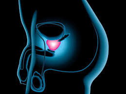 Read more about the article Alarming Symptoms of Prostate Cancer