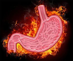 Read more about the article Gastritis, Ulcer And Natural Medicines