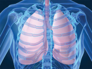 Read more about the article Pneumonia – Symptoms and Risk Factors