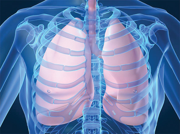 You are currently viewing Pneumonia – Symptoms and Risk Factors